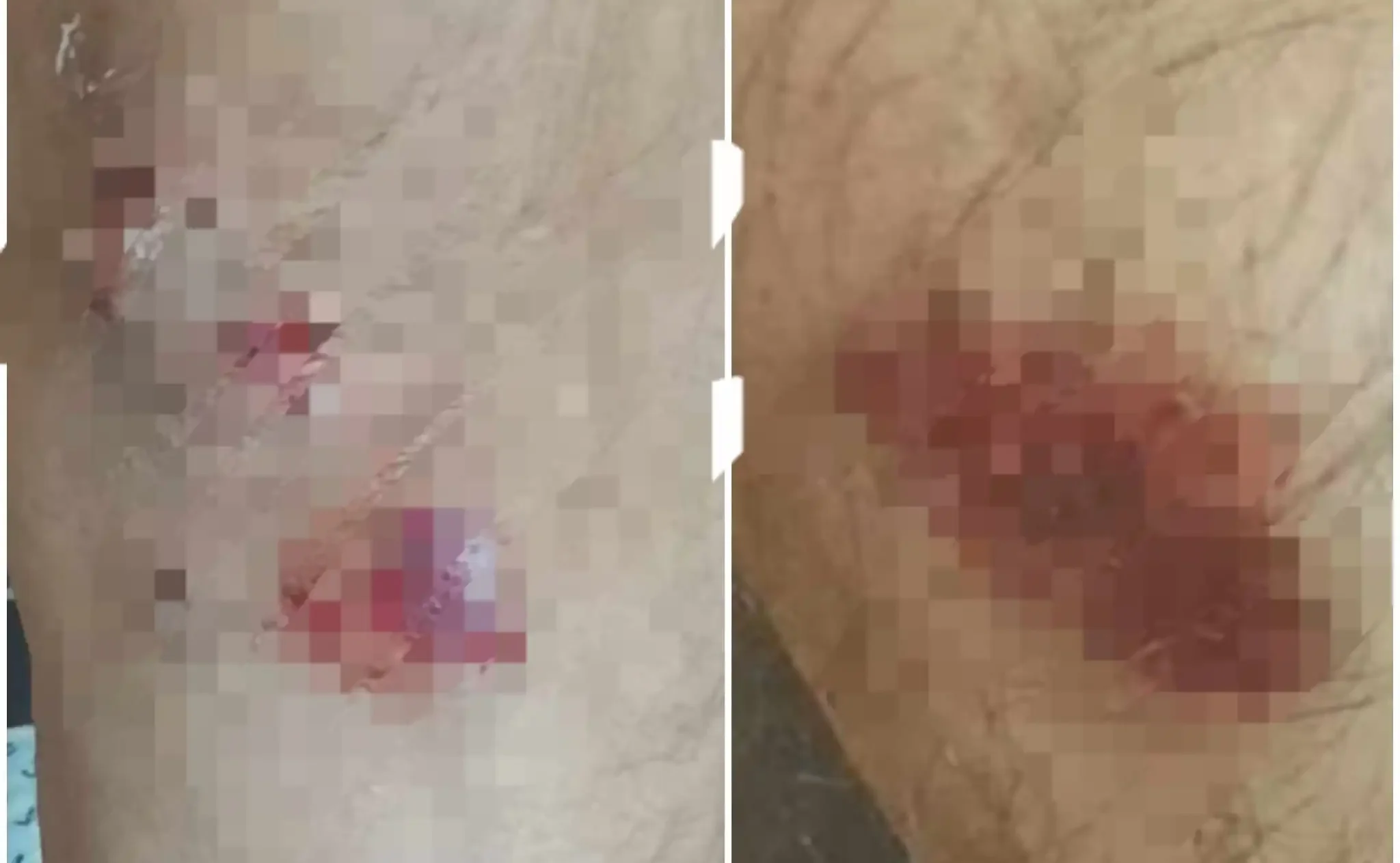 צילום חלק מפציעות המותקף