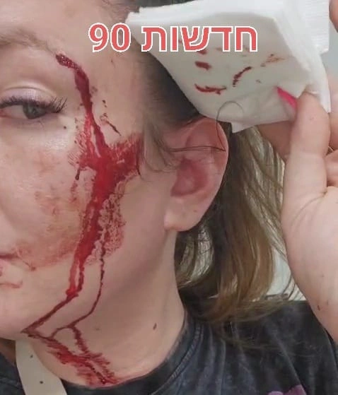 תמונת המותקפת עם הפציעה המדממת